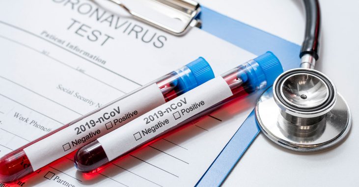 coronavírus diabetes profitus